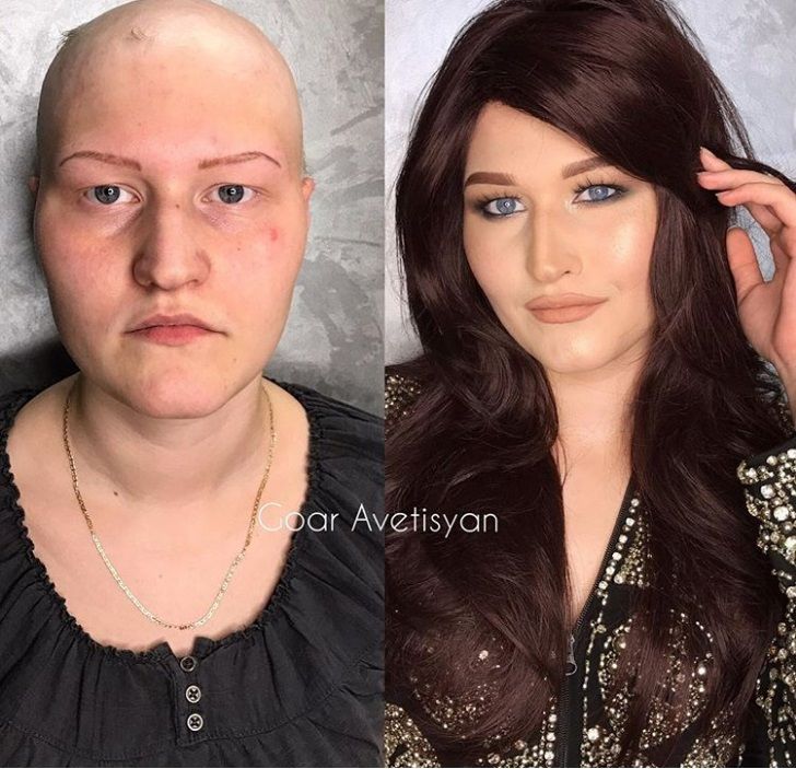 Cette make-up artiste transforme les femmes malades, cancéreuses ou brûlées grâce au maquillage pour leur redonner confiance en elles | So Busy Girls