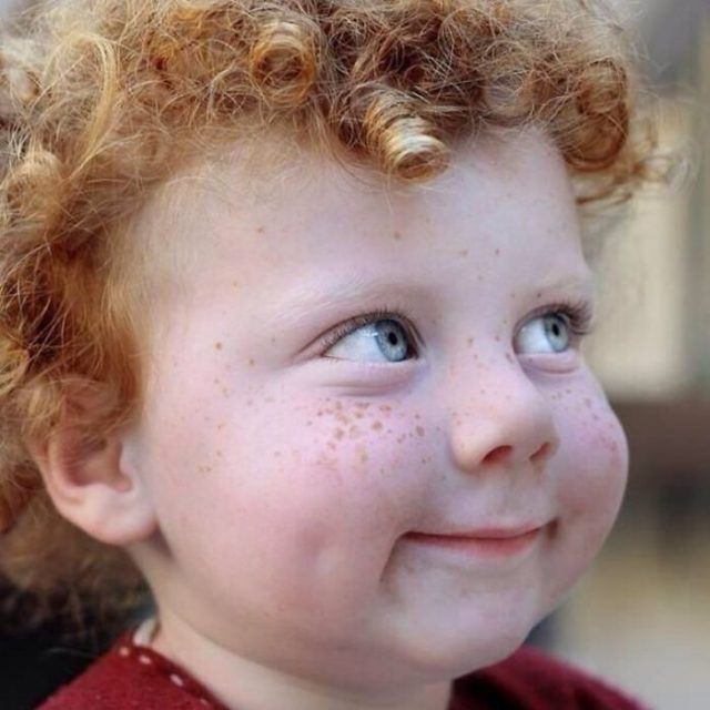 13 personnes magnifiques et remarquables grâce à la beauté unique de leurs taches de rousseur | So Busy Girls