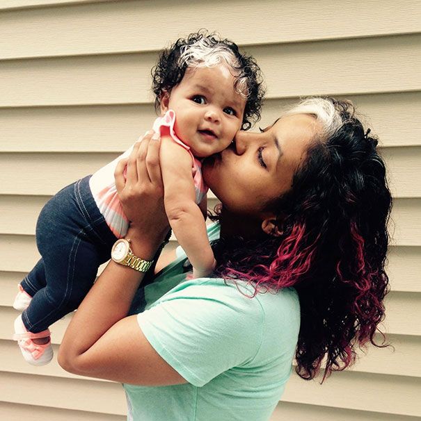 Cette petite fille est née avec la même mèche de cheveux blancs que sa maman | So Busy Girls
