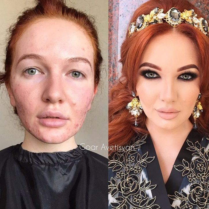 Cette make-up artiste transforme les femmes malades, cancéreuses ou brûlées grâce au maquillage pour leur redonner confiance en elles | So Busy Girls