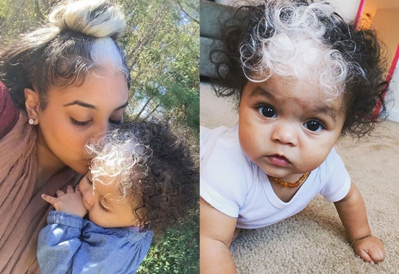 Cette petite fille est née avec la même mèche de cheveux blancs que sa maman | So Busy Girls