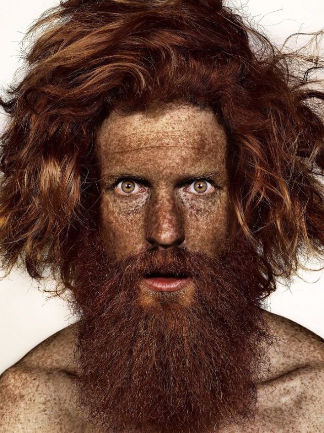 13 personnes magnifiques et remarquables grâce à la beauté unique de leurs taches de rousseur | So Busy Girls