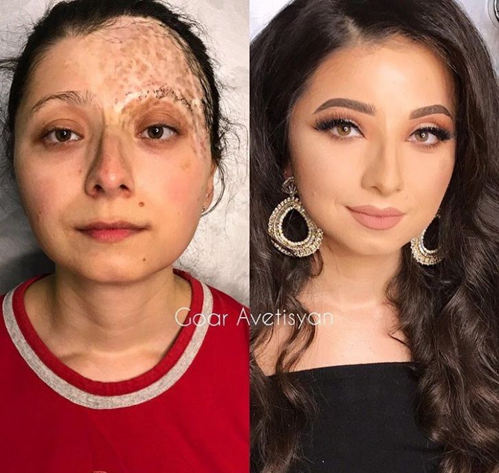 Cette make-up artiste transforme les femmes malades, cancéreuses ou brûlées grâce au maquillage pour leur redonner confiance en elles | So Busy Girls