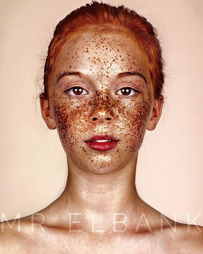 15 photos qui prouvent que les taches de rousseur sont magnifiques | So Busy Girls