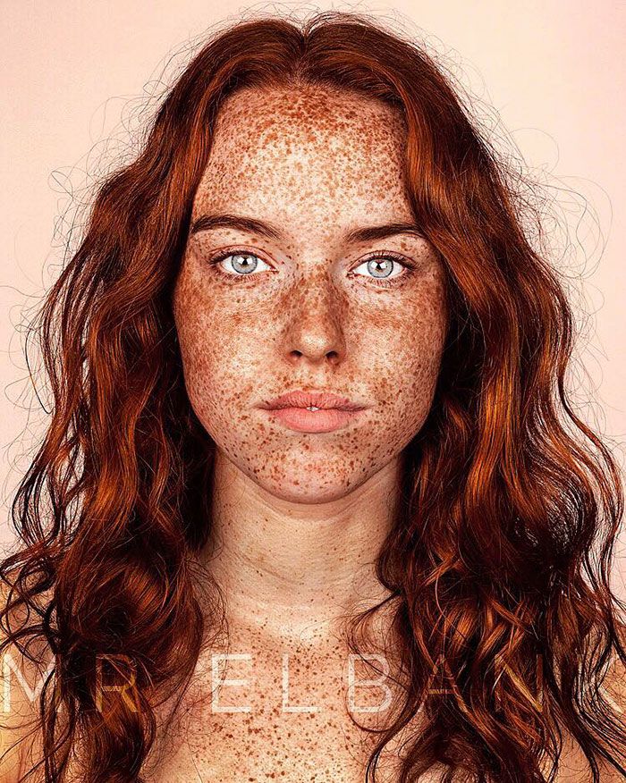 15 photos qui prouvent que les taches de rousseur sont magnifiques | So Busy Girls