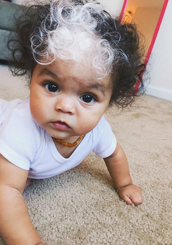 Cette petite fille est née avec la même mèche de cheveux blancs que sa maman | So Busy Girls