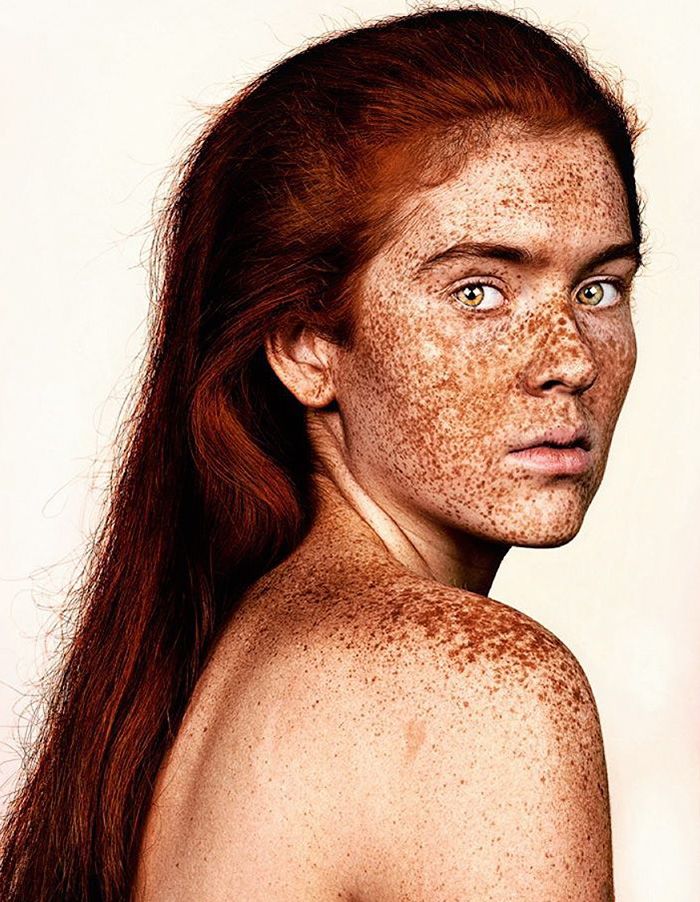 15 photos qui prouvent que les taches de rousseur sont magnifiques | So Busy Girls