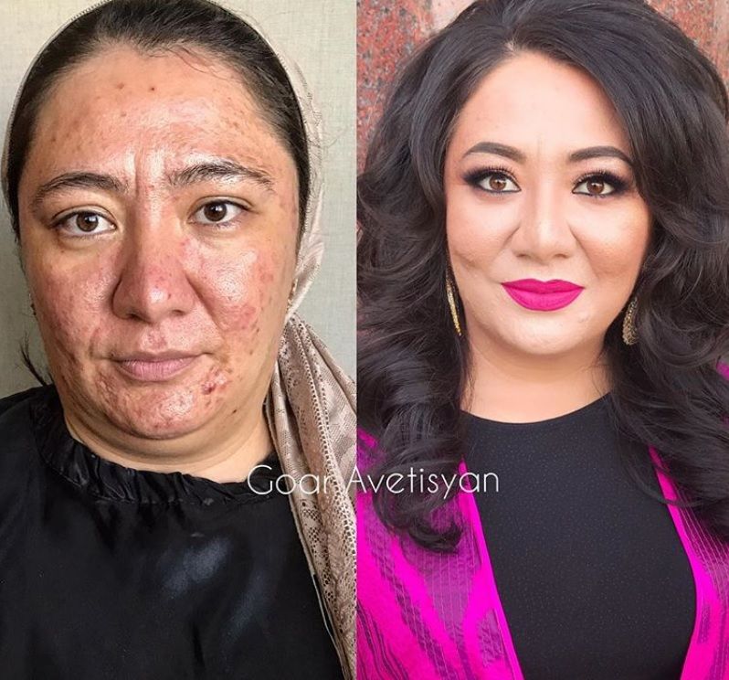 Cette make-up artiste transforme les femmes malades, cancéreuses ou brûlées grâce au maquillage pour leur redonner confiance en elles | So Busy Girls