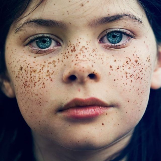 13 personnes magnifiques et remarquables grâce à la beauté unique de leurs taches de rousseur | So Busy Girls