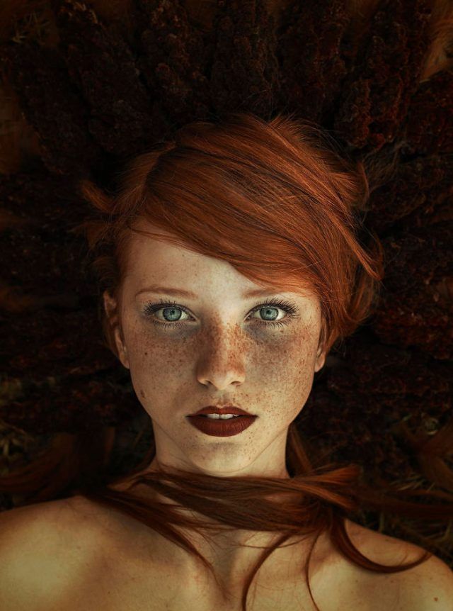 13 personnes magnifiques et remarquables grâce à la beauté unique de leurs taches de rousseur | So Busy Girls