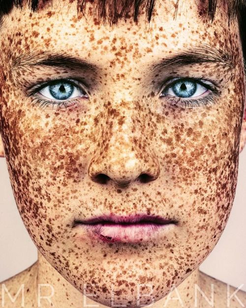 15 photos qui prouvent que les taches de rousseur sont magnifiques | So Busy Girls
