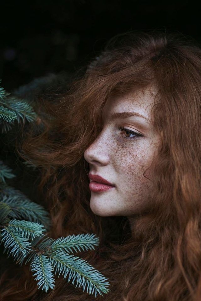 13 personnes magnifiques et remarquables grâce à la beauté unique de leurs taches de rousseur | So Busy Girls