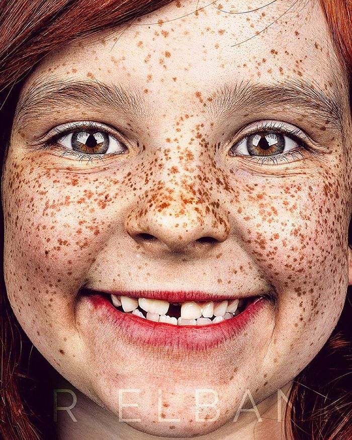 15 photos qui prouvent que les taches de rousseur sont magnifiques | So Busy Girls