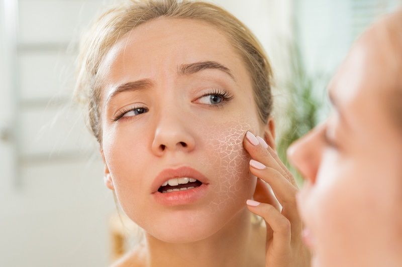 Voilà pourquoi votre peau est plus sèche depuis le début du confinement | So Busy Girls