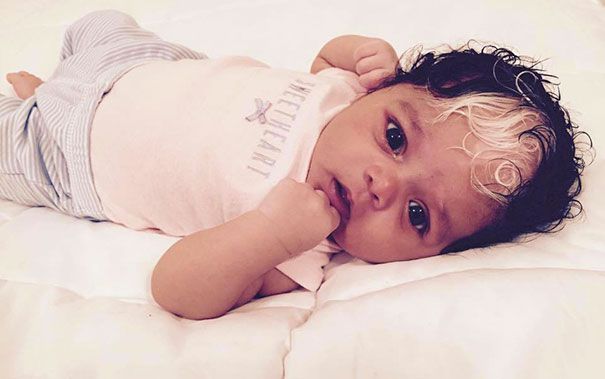 Cette petite fille est née avec la même mèche de cheveux blancs que sa maman | So Busy Girls