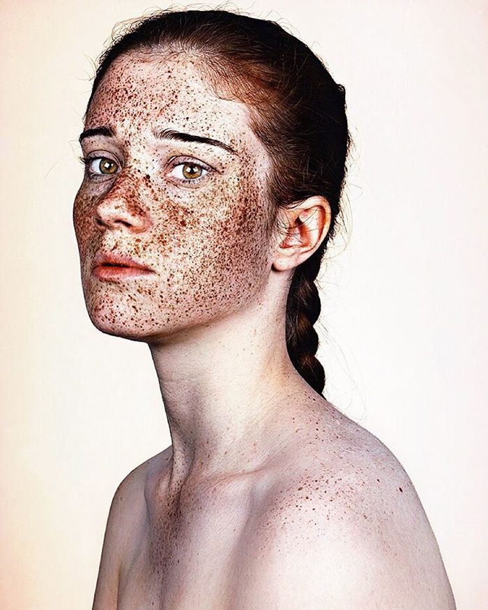 15 photos qui prouvent que les taches de rousseur sont magnifiques | So Busy Girls