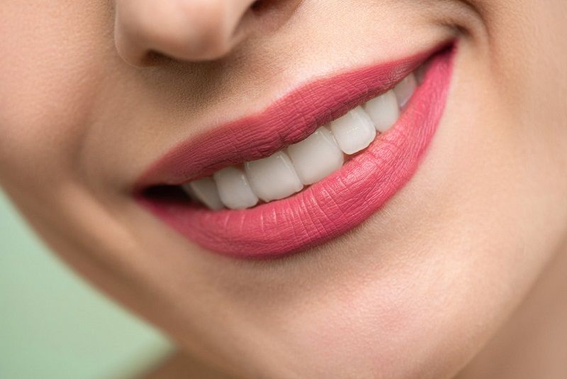 3 conseils pour bénéficier de meilleurs soins dentaires | So Busy Girls