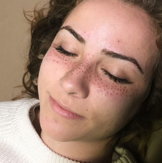 La dernière tendance tatouage : se faire tatouer des taches de rousseur sur le visage ! | So Busy Girls