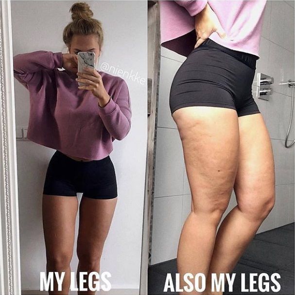 Ces 12 femmes nous prouvent que le corps parfait n'est qu'une illusion (et ça fait du bien !) | So Busy Girls