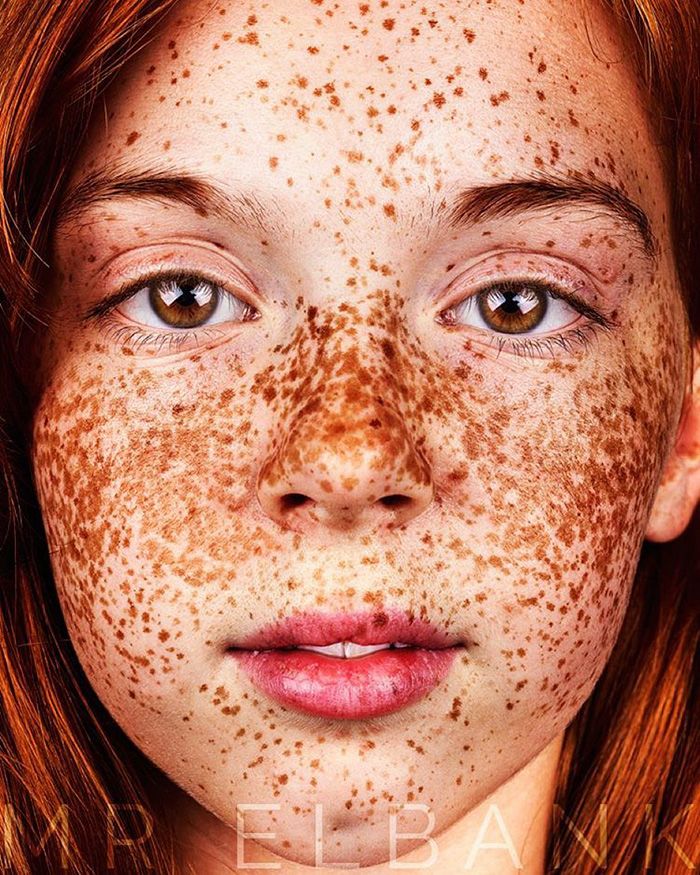 15 photos qui prouvent que les taches de rousseur sont magnifiques | So Busy Girls