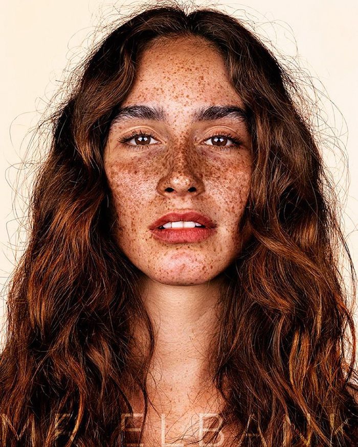 15 photos qui prouvent que les taches de rousseur sont magnifiques | So Busy Girls