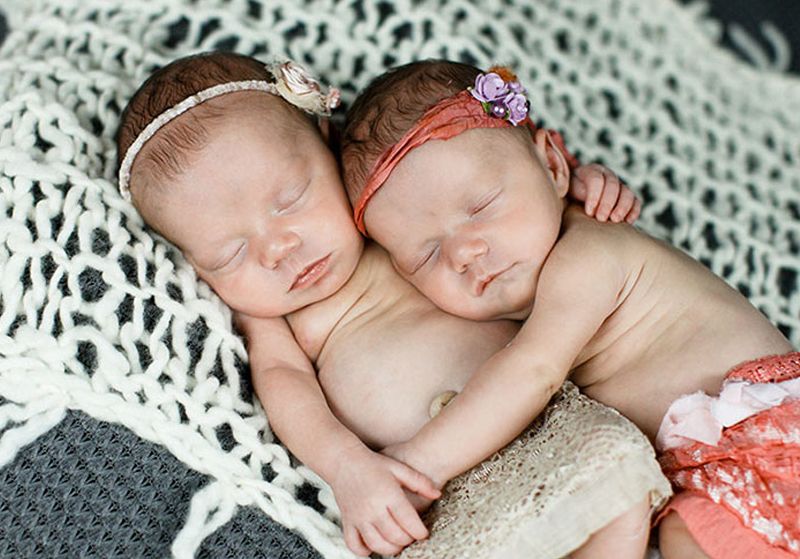 Ces jumelles sont nées en se tenant la main et 2 ans après, elles sont vraiment inséparables ! | So Busy Girls