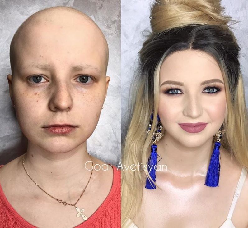 Cette make-up artiste transforme les femmes malades, cancéreuses ou brûlées grâce au maquillage pour leur redonner confiance en elles | So Busy Girls