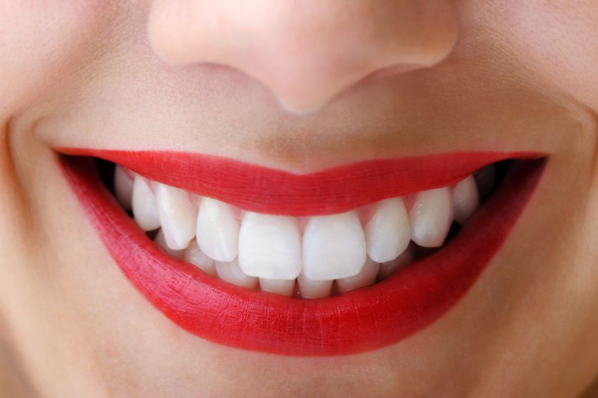 5 conseils pour prendre soin de ses dents | So Busy Girls