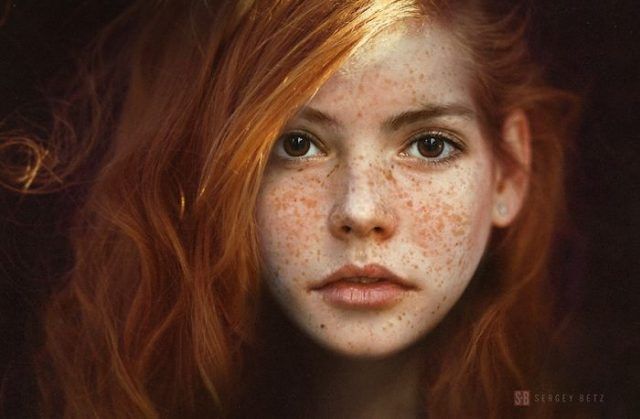 13 personnes magnifiques et remarquables grâce à la beauté unique de leurs taches de rousseur | So Busy Girls