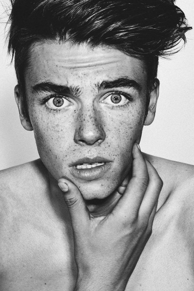 13 personnes magnifiques et remarquables grâce à la beauté unique de leurs taches de rousseur | So Busy Girls