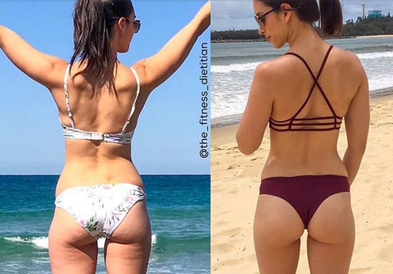 5 conseils efficaces pour diminuer la cellulite | So Busy Girls