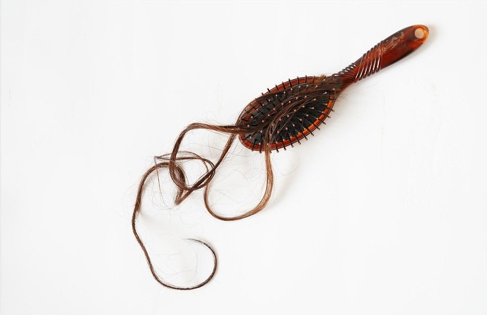 Evolution d’une greffe de cheveux : Résultats par mois | So Busy Girls