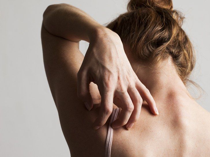 boutons-acne-dos-femme-qui-se-gratte