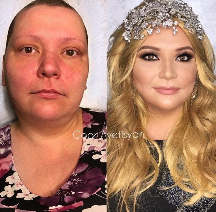 Cette make-up artiste transforme les femmes malades, cancéreuses ou brûlées grâce au maquillage pour leur redonner confiance en elles | So Busy Girls