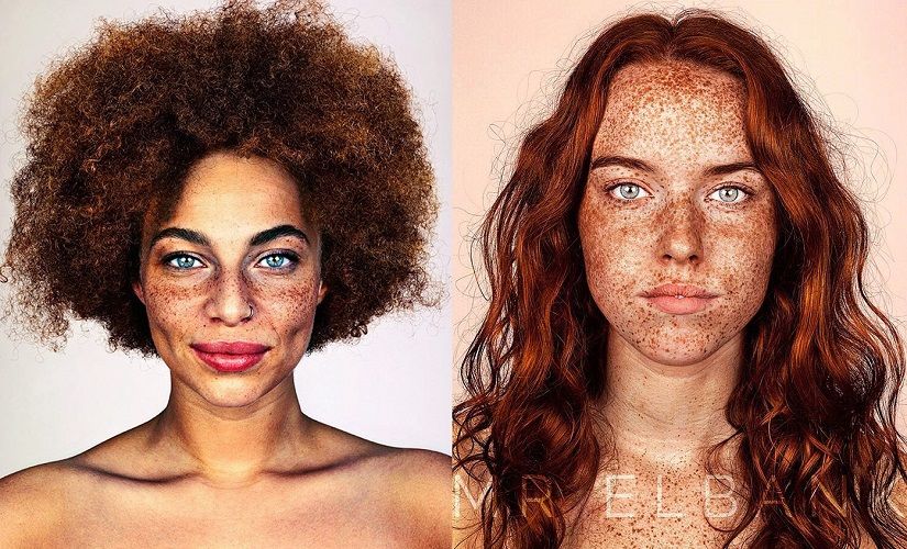 15 photos qui prouvent que les taches de rousseur sont magnifiques | So Busy Girls