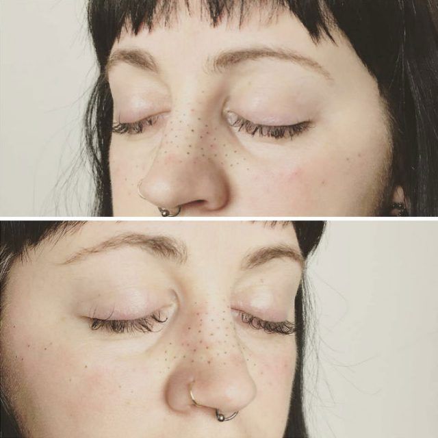 La dernière tendance tatouage : se faire tatouer des taches de rousseur sur le visage ! | So Busy Girls
