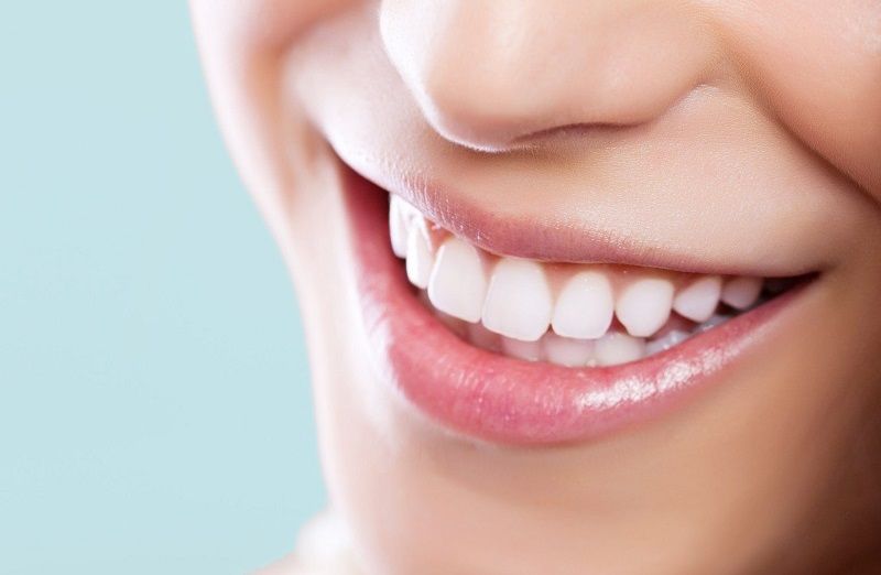 Comment avoir les dents blanches ? Les conseils efficaces.