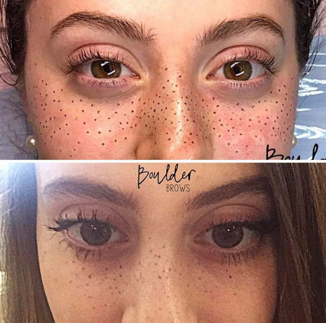 La dernière tendance tatouage : se faire tatouer des taches de rousseur sur le visage ! | So Busy Girls