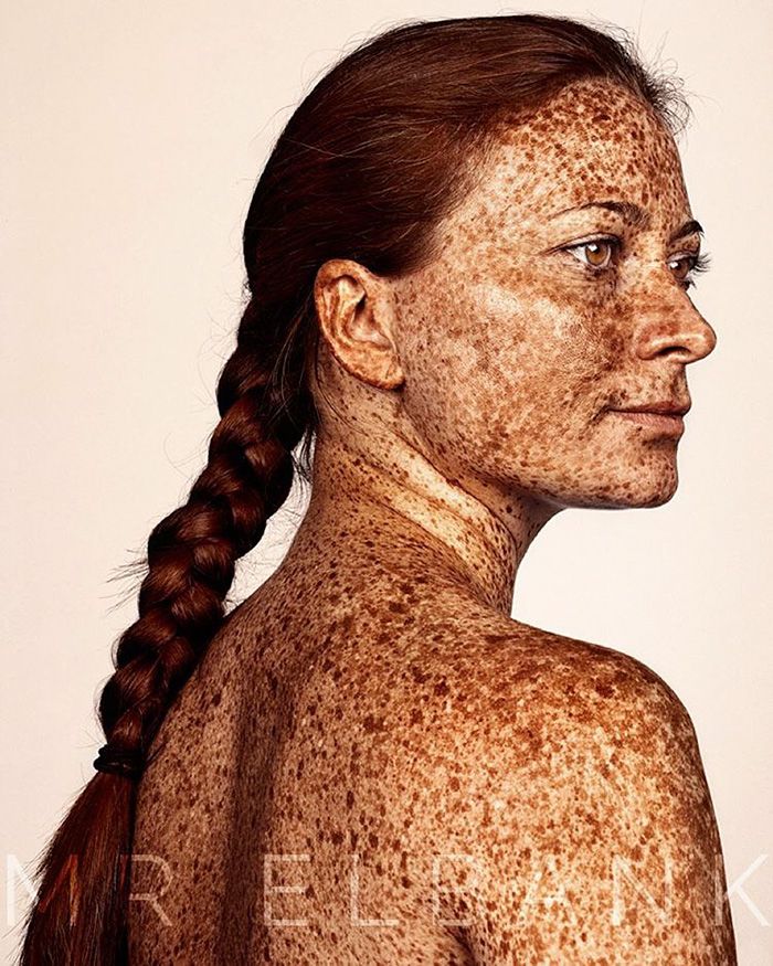 15 photos qui prouvent que les taches de rousseur sont magnifiques | So Busy Girls