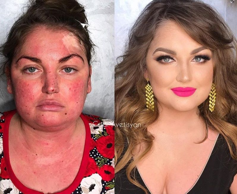Cette make-up artiste transforme les femmes malades, cancéreuses ou brûlées grâce au maquillage pour leur redonner confiance en elles | So Busy Girls