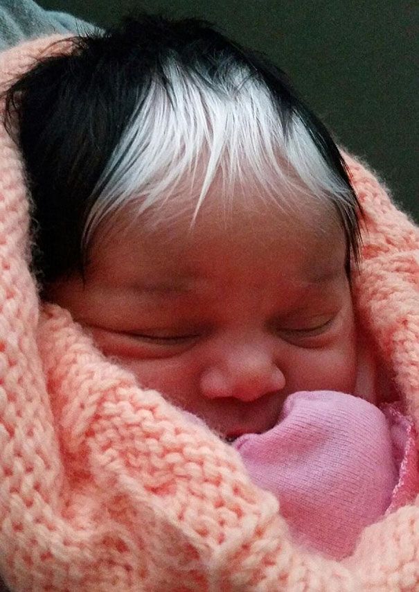 Cette petite fille est née avec la même mèche de cheveux blancs que sa maman | So Busy Girls