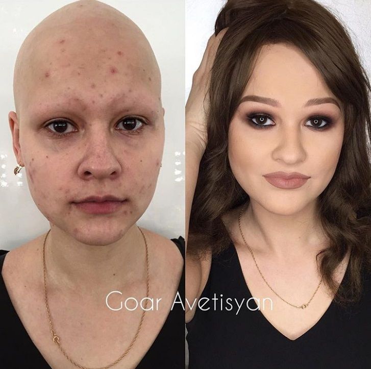 Cette make-up artiste transforme les femmes malades, cancéreuses ou brûlées grâce au maquillage pour leur redonner confiance en elles | So Busy Girls