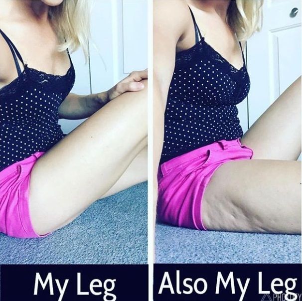 Ces 12 femmes nous prouvent que le corps parfait n'est qu'une illusion (et ça fait du bien !) | So Busy Girls