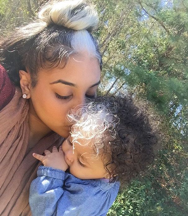 Cette petite fille est née avec la même mèche de cheveux blancs que sa maman | So Busy Girls