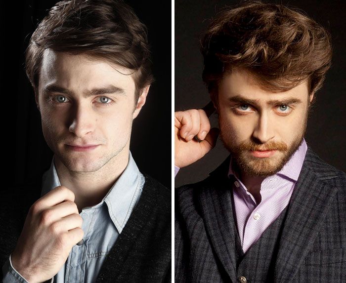 Daniel Radcliffe | So Busy Girls