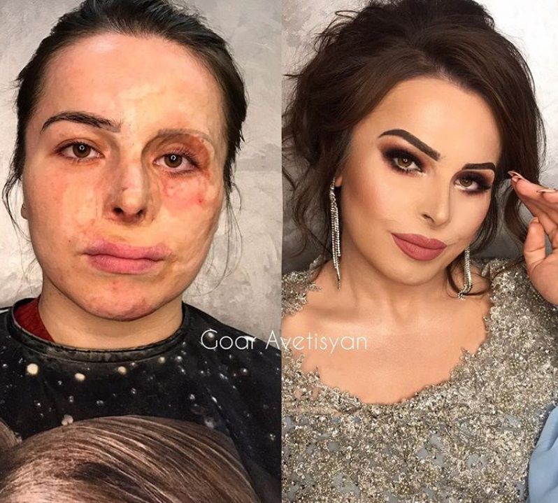 Cette make-up artiste transforme les femmes malades, cancéreuses ou brûlées grâce au maquillage pour leur redonner confiance en elles | So Busy Girls