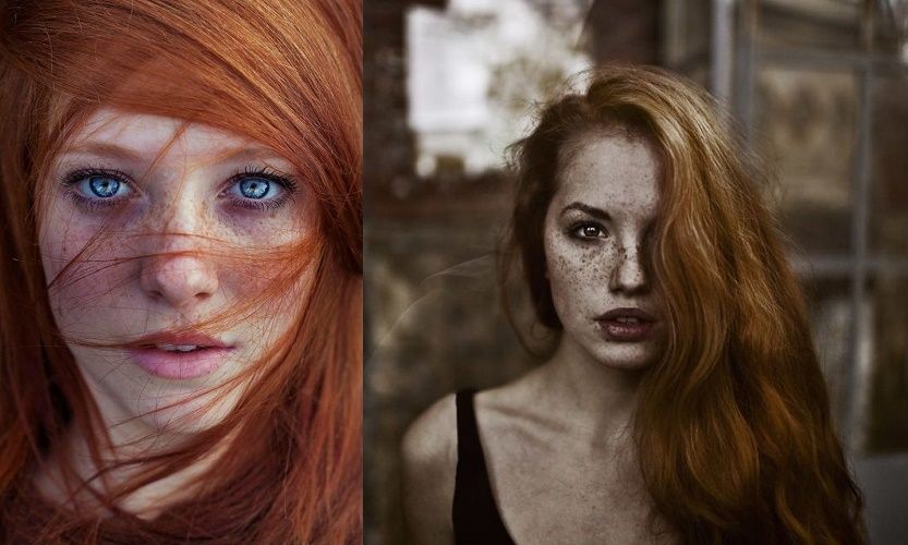 13 personnes magnifiques et remarquables grâce à la beauté unique de leurs taches de rousseur | So Busy Girls