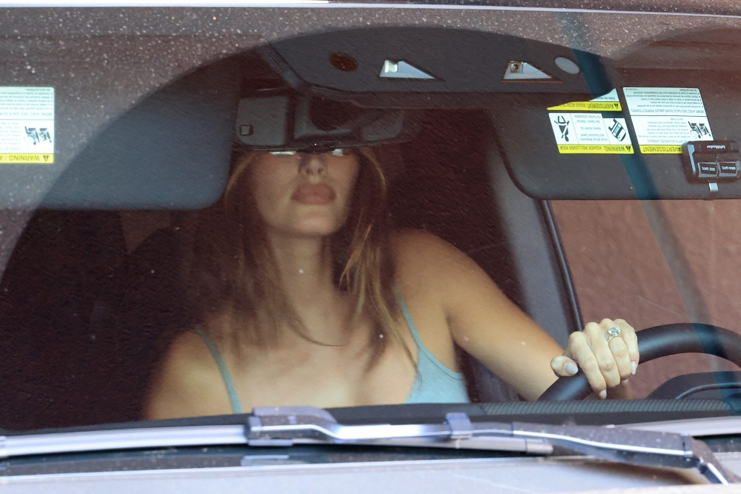 Chirurgie ratée, lèvres déformées : pourquoi les photos de Hailey Bieber sortant d'une clinique esthétique font le buzz