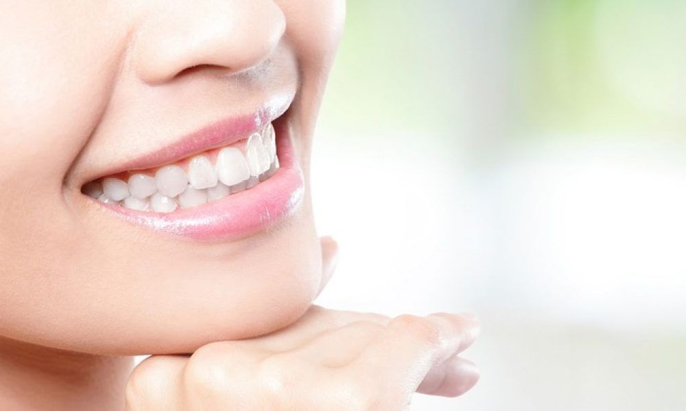 5 choses à savoir sur le blanchiment dentaire | So Busy Girls