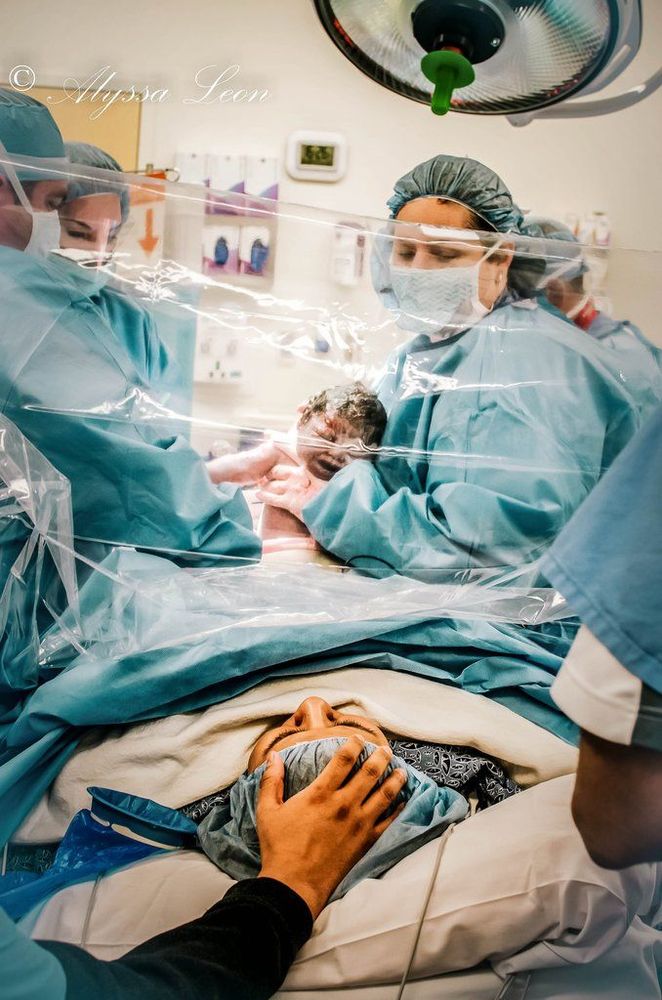 Vous n'avez jamais vu de photos d'accouchement par césarienne aussi belles que celles-ci | So Busy Girls